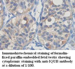 Anti-IQUB - image 1