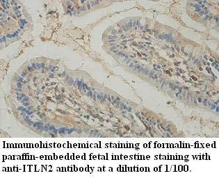Anti-ITLN2 - image 1