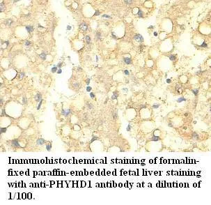 Anti-PHYHD1 - image 1