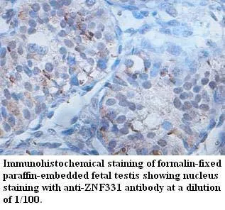 Anti-ZNF331 - image 1