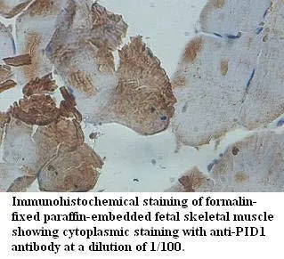 Anti-PID1 - image 1