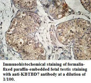 Anti-KBTBD7 - image 1