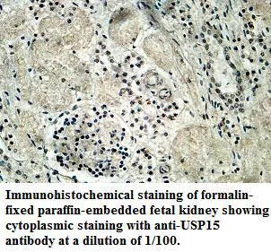 Anti-USP15 - image 1