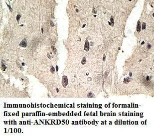 Anti-ANKRD50 - image 1