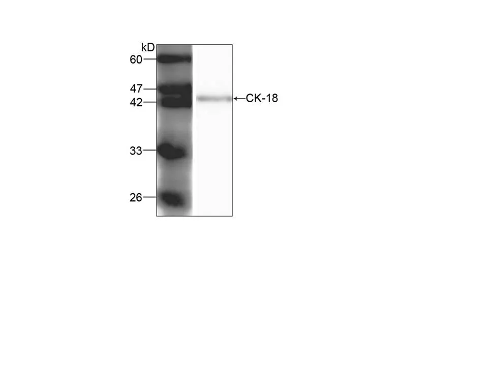 Anti-CK18 - image 1