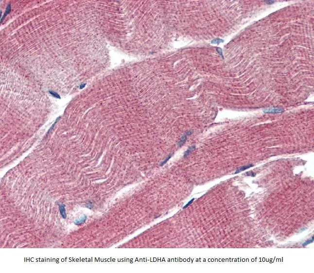 Anti-LDHA - image 1
