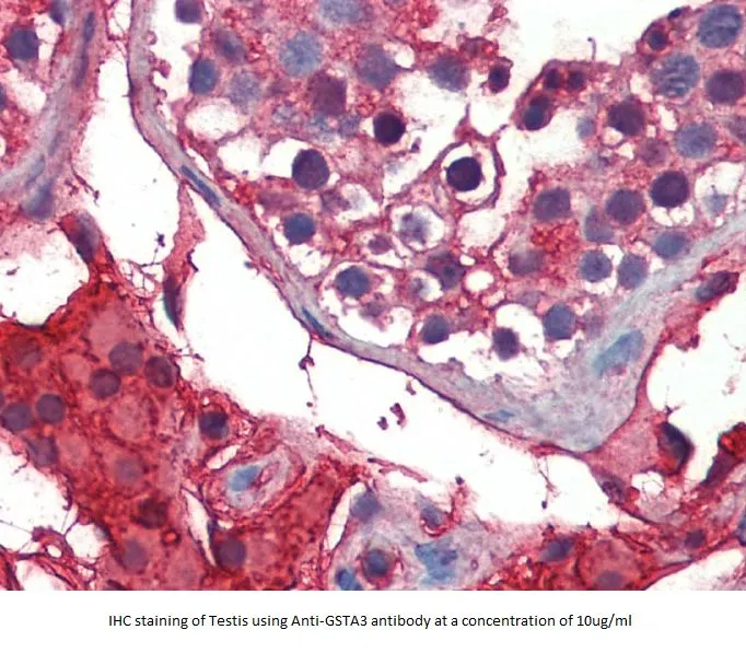 Anti-GSTA3 - image 1