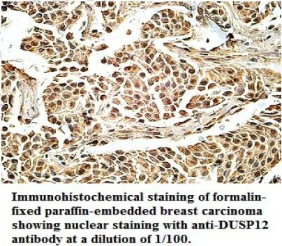 Anti-DUSP12 - image 1