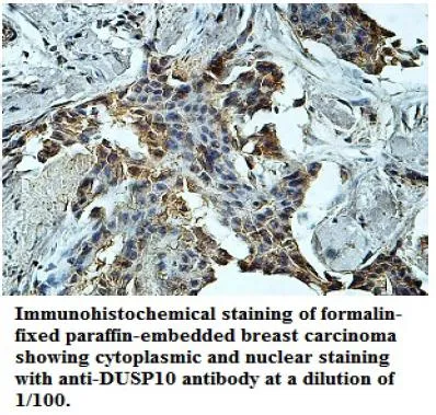 Anti-DUSP10 - image 1