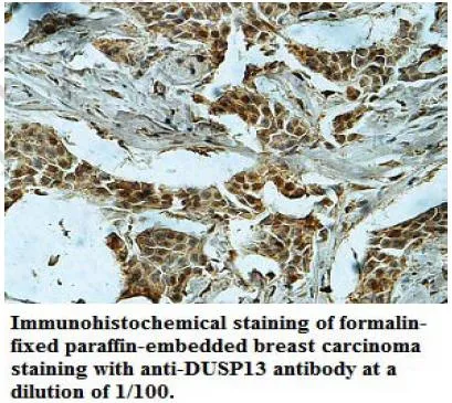 Anti-DUSP13 - image 1