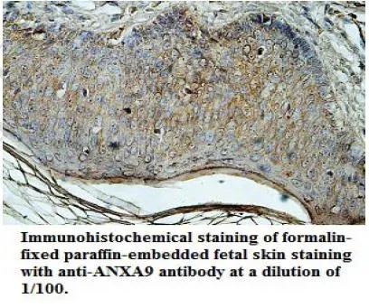 Anti-MECP2 - image 1