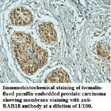 Anti-RAB18 - image 1