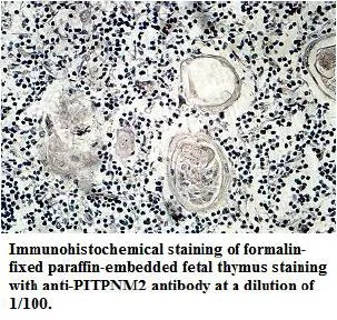 Anti-PITPNM2 - image 1