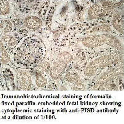 Anti-PISD - image 1