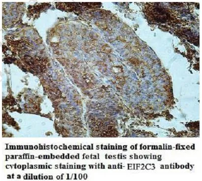 Anti-EIF2C3 - image 1