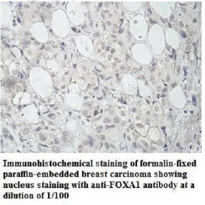 Anti-FOXA1 - image 1