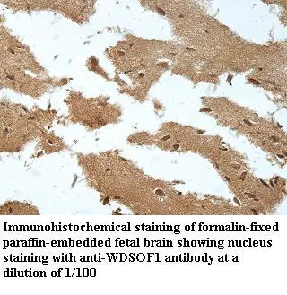 Anti-WDSOF1 - image 1
