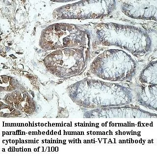 Anti-VTA1 - image 1
