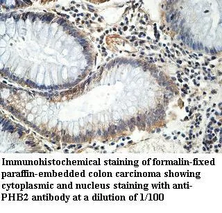 Anti-PHB2 - image 1