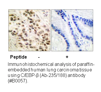 C/EBP-β (Ab-235/188) Antibody - image 1