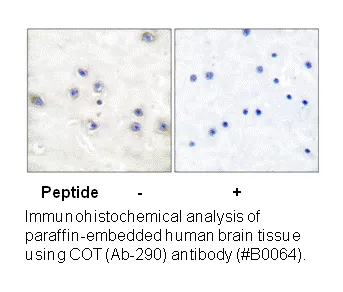 COT (Ab-290) Antibody - image 3