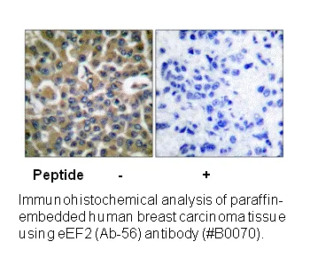 EEF2 (Ab-56) Antibody - image 2