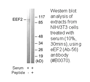 EEF2 (Ab-56) Antibody - image 3