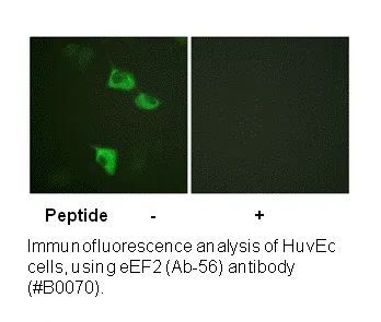 EEF2 (Ab-56) Antibody - image 1