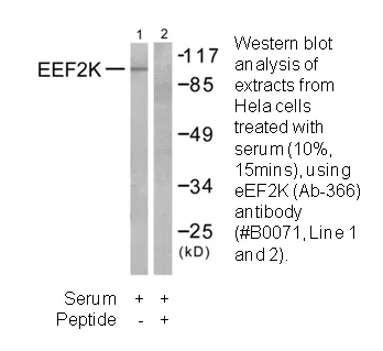 EEF2K (Ab-366) Antibody - image 1