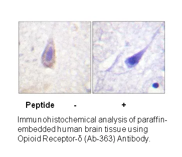 Opioid Receptor-δ (Ab-363) Antibody - image 2