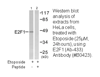 E2F1 (Ab-433) Antibody - image 1