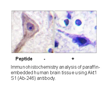 Akt1 S1 (Ab-246) Antibody - image 1