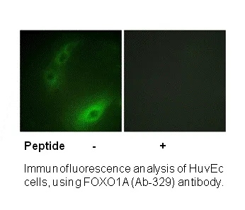FOXO1A (Ab-329) Antibody
