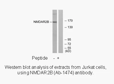 NMDAR2B (Ab-1474) Antibody - image 1