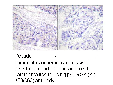 p90 RSK (Ab-359/363) Antibody - image 1