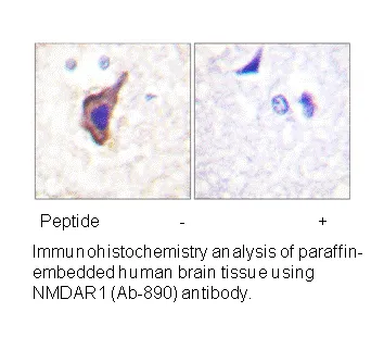 NMDAR1 (Ab-890) Antibody - image 1