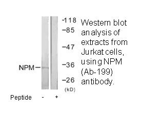 NPM (Ab-199) Antibody - image 2