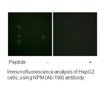NPM (Ab-199) Antibody - image 1