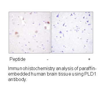 PLD1 (Ab-561) Antibody - image 1