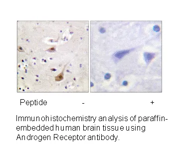 Androgen Receptor (Ab-94) Antibody - image 2