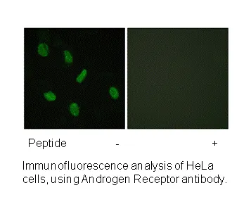 Androgen Receptor (Ab-94) Antibody - image 1