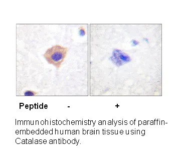 Catalase (Ab-385) Antibody - image 1