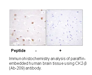 CKII-β (Ab-209) Antibody - image 1