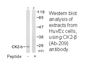 CKII-β (Ab-209) Antibody - image 2