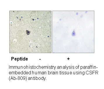 CSFR (Ab-809) Antibody - image 2