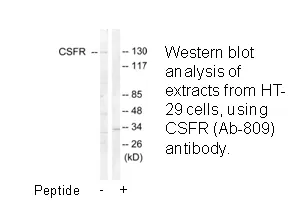 CSFR (Ab-809) Antibody - image 3