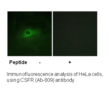 CSFR (Ab-809) Antibody - image 1