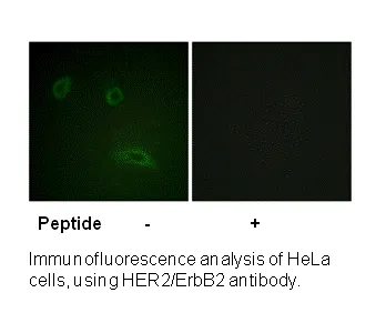 HER2 (Ab-1139) Antibody - image 1