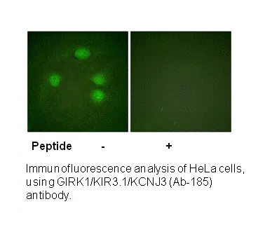 GIRK1/KIR3.1/KCNJ3 (Ab-185) Antibody - image 1