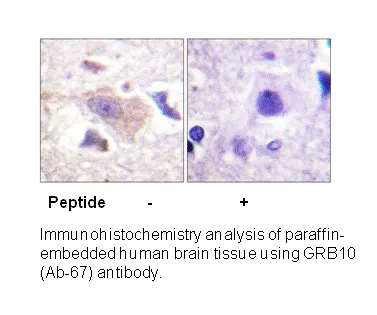 GRB10 (Ab-67) Antibody - image 2